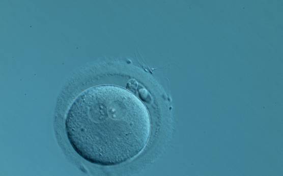 <p><strong>Figure 142</strong></p><p>A zygote generated by IVF with normal-sized PNs slightly displaced to a peripheral position (400× magnification). NPBs are aligned and different in number. It was transferred but the outcome is unknown.</p>