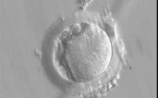 <p><strong>Figure 143</strong></p><p>A deformed zygote at 16 h post-IVF displaying two PNs located peripherally in the cytoplasm (6–7 o'clock) that are parallel to the plane of the two large polar bodies (400× magnification).</p>