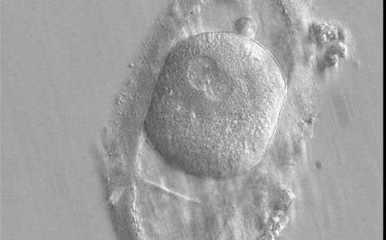 <p><strong>Figure 146</strong></p><p>A zygote generated by ICSI displaying an ovoid ZP which demonstrates a duplication or tear in the layers (400× magnification). The fertilized oocyte is spherical and shows two PNs peripherally located and partly overlapping in this view. NPBs are small and scattered in both PNs. It was transferred and implanted.</p>