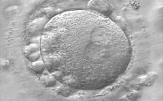 <p><strong>Figure 158</strong></p><p>A zygote generated by IVF at 16.40 h post-insemination (400× magnification). It shows small-sized NPBs scattered with respect to the PN junction and a lot of large cellular debris in the PVS. It was discarded.</p>