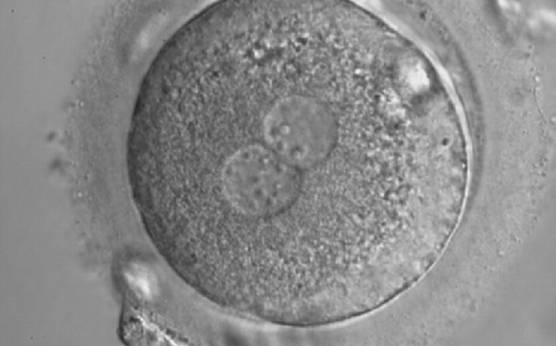 <p><strong>Figure 159</strong></p><p>A zygote with inequality in numbers and alignment of NPBs. It was cryopreserved.</p>