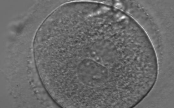 <p><strong>Figure 160</strong></p><p>A zygote generated by ICSI with inequality in numbers and alignment of NPBs (400× magnification). NPBs are aligned in one PN and scattered in the other. Due to poor development, it was discarded.</p>
