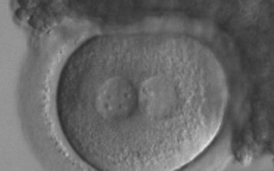 <p><strong>Figure 163</strong></p><p>A zygote generated by ICSI with inequality in numbers and alignment of NPBs (200× magnification). Many granulosa cells are adherent to the ZP. It was transferred and implanted.</p>