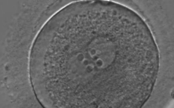 <p><strong>Figure 166</strong></p><p>A zygote generated by ICSI with equal numbers of large-sized NPBs aligned at the PN junction (400× magnification). There is a halo in the cortical area; polar bodies are fragmented and the ZP appears brush-like. It was discarded due to subsequent abnormal development.</p>