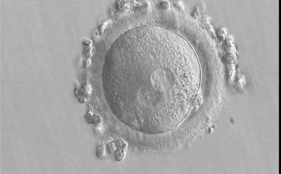 <p><strong>Figure 168</strong></p><p>A zygote generated by IVF using frozen/thawed ejaculated sperm and observed 15 h post-insemination (400× magnification). Two PNs of approximately the same size are clearly visible in the cytoplasm. Peripheral granular cytoplasm can be seen. NPBs are scattered in both PNs. Both polar bodies are located at the 4 o'clock position. It was transferred and implanted.</p>