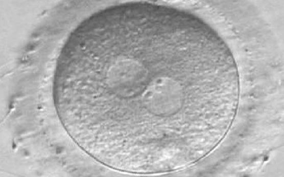 <p><strong>Figure 171</strong></p><p>A zygote observed at 16 h post-IVF displaying different number and size of NPBs: small and scattered in one PN, large and aligned in the other (400× magnification). It was discarded because of developmental arrest.</p>