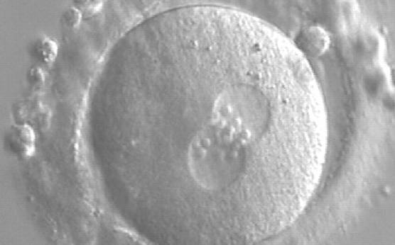 <p><strong>Figure 173</strong></p><p>A zygote generated by ICSI showing equal number and size of NPBs, which are aligned at the PN junction (200× magnification). PNs are tangential to the plane of the polar bodies. It was transferred and resulted in a singleton pregnancy and delivery.</p>