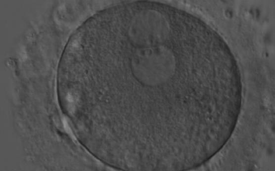 <p><strong>Figure 174</strong></p><p>A zygote generated by ICSI with peripherally located PNs showing NPBs of similar size and number (200× magnification). Further development resulted in uneven cleavage and arrest on Day 3.</p>