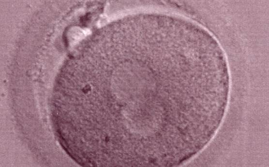 <p><strong>Figure 182</strong></p><p>The second out of three sibling zygotes (see also Figs 181 and 183) generated by ICSI using frozen/thawed epididymal sperm. All three zygotes showed refractile bodies in the cytoplasm.</p>