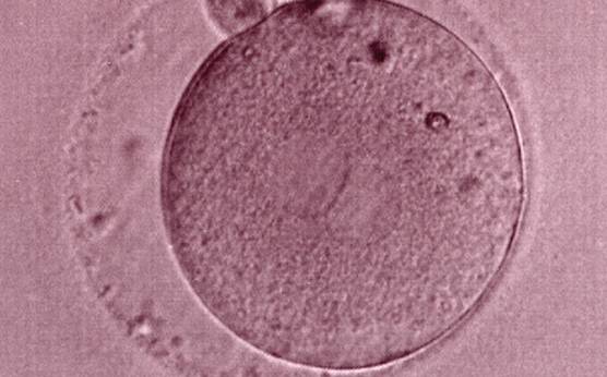 <p><strong>Figure 183</strong></p><p>The third of three sibling zygotes (see also Figs 181 and 182) generated by ICSI using frozen/thawed epididymal sperm. Beside the absence of NPBs and the presence of refractile bodies, this zygote has a large perivitelline space.</p>