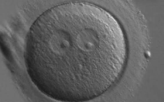 <p><strong>Figure 185</strong></p><p>A zygote generated by ICSI showing two ‘bull's eye’ PNs, each having a single large NPB (200× magnification). The PNs are slightly separated and are not as yet juxtaposed. A clear cortical region is evident in the cytoplasm. It was discarded.</p>