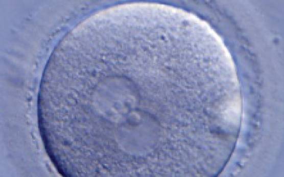 <p><strong>Figure 189</strong></p><p>A zygote generated by ICSI with one ‘bull's eye’ PN (400× magnification). The NPBs from each PN are aligned at the PN junction. It was transferred but clinical outcome is unknown.</p>