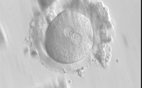 <p><strong>Figure 190</strong></p><p>A zygote generated by IVF with frozen/thawed ejaculated sperm and observed at 16 h post-insemination showing normal cytoplasmic morphology (400× magnification). NPBs are obviously different in the two PNs. It was transferred but failed to implant.</p>