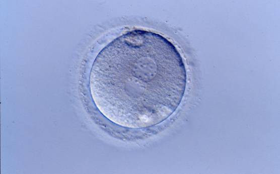 <p><strong>Figure 193</strong></p><p>A zygote generated by ICSI showing normal cytoplasmic morphology, a thin ZP and small debris in an enlarged PVS (400× magnification). It was transferred but clinical outcome is unknown.</p>