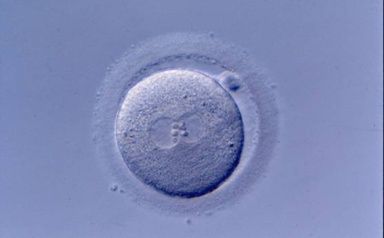 <p><strong>Figure 194</strong></p><p>A zygote generated by ICSI showing normal cytoplasmic morphology except for a refractile body visible at the 3 o'clock position in this view (400× magnification). It was transferred but clinical outcome is unknown.</p>