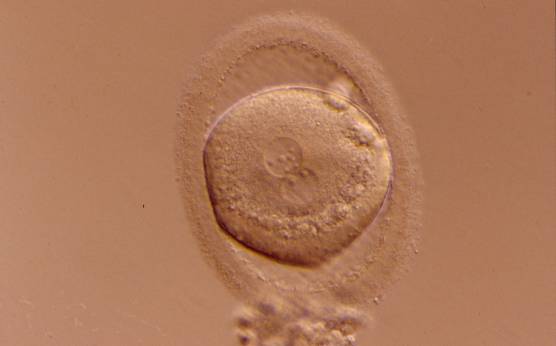 <p><strong>Figure 198</strong></p><p>A zygote generated by ICSI displaying granular cytoplasm, especially in the area immediately adjacent to the clear cortical zone (400× magnification). There is an enlarged PVS and an ovoid ZP. NPBs differ in number and size. It was transferred but clinical outcome is unknown.</p>