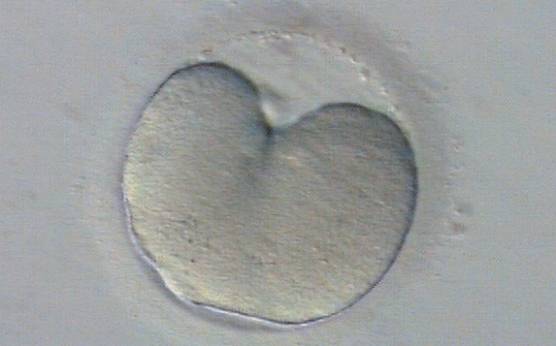 <p><strong>Figure 211</strong></p><p>A zygote undergoing first mitosis which has not been completed by 25 h post-insemination. The mitotic groove can be seen. This embryo should still be assessed as a 1-cell embryo.</p>