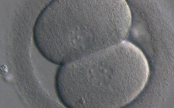 <p><strong>Figure 213</strong></p><p>A 2-cell embryo with evenly sized blastomeres each containing one nucleus. Generated by ICSI but was not transferred.</p>