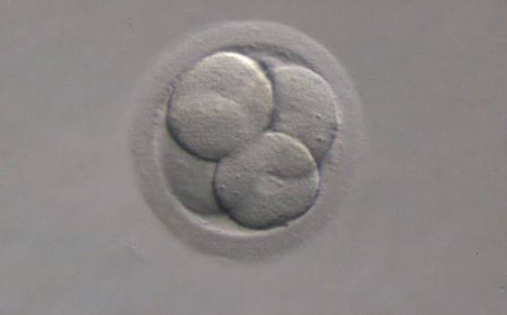 <p><strong>Figure 215</strong></p><p>A 4-cell embryo with four evenly sized blastomeres each one containing one nucleus. Generated by ICSI. The embryo was transferred and implanted.</p>