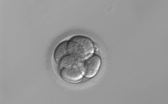 <p><strong>Figure 216</strong></p><p>A 5-cell embryo where one cell is slightly out of focus. There is a slight difference in cell size but not significant enough to be called an uneven sized embryo. It was generated by ICSI and cryopreserved.</p>