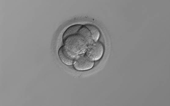 <p><strong>Figure 217</strong></p><p>A 6-cell embryo with four small and two larger blastomeres, i.e. it has a stage-specific cell size (see Section C). The embryo was generated by IVF and cryopreserved.</p>