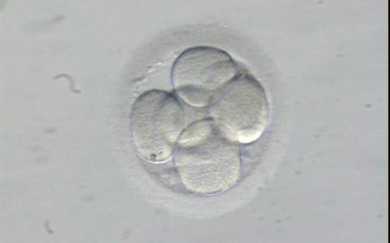 <p><strong>Figure 218</strong></p><p>A 7-cell embryo in which four of the blastomeres show a single nucleus. The embryo was generated by ICSI, it was transferred and implanted.</p>