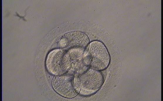 <p><strong>Figure 219</strong></p><p>An 8-cell embryo with evenly sized blastomeres with no visible nuclei. It was generated by ICSI and transferred but the outcome is unknown.</p>