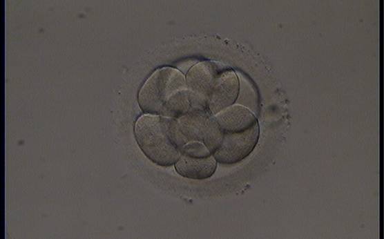 <p><strong>Figure 220</strong></p><p>A cryopreserved 9-cell embryo, warmed on Day 3. One blastomere is slightly larger and one blastomere is slightly smaller than the others. It was generated by ICSI and transferred but failed to implant.</p>