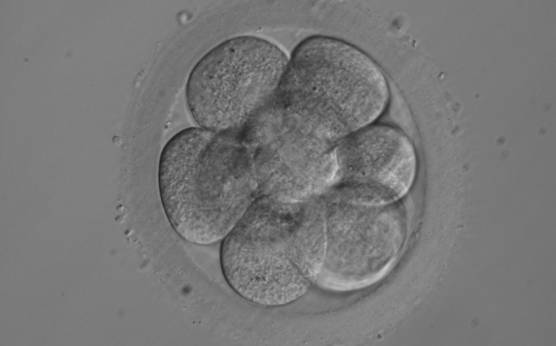 <p><strong>Figure 221</strong></p><p>A 10-cell embryo with visible nuclei in some blastomeres. It was generated by ICSI and cryopreserved.</p>