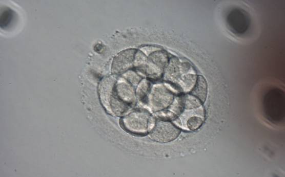 <p><strong>Figure 222</strong></p><p>An embryo with more than 10 cells on Day 4. This embryo has not compacted which is unusual at this late stage. Generated by ICSI and cryopreserved.</p>