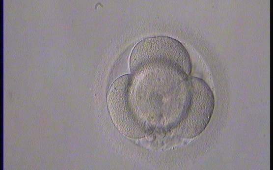 <p><strong>Figure 223</strong></p><p>Day 2 4-cell embryo with <10% fragmentation and evenly sized blastomeres. It was generated by ICSI but not transferred.</p>