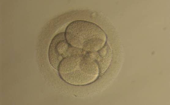 <p><strong>Figure 224</strong></p><p>Day 2 4-cell embryo with <10% scattered fragmentation and evenly sized blastomeres. It was generated by IVF but not transferred.</p>