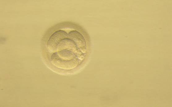 <p><strong>Figure 225</strong></p><p>Day 2 4-cell embryo with <10% fragmentation and evenly sized blastomeres. Fragments are concentrated in one area of the perivitelline space (PVS). It was generated by ICSI and transferred but the outcome is unknown.</p>