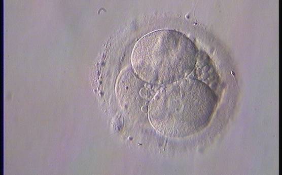<p><strong>Figure 227</strong></p><p>A 4-cell embryo with 10–15% scattered fragmentation, evenly sized blastomeres and a single nucleus in some blastomeres. It was generated by IVF and cryopreserved.</p>