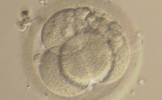 <p><strong>Figure 228</strong></p><p>A 4-cell embryo with 10–20% concentrated fragmentation, evenly sized blastomeres and no visible nuclei. It was generated by IVF, was transferred but failed to implant.</p>