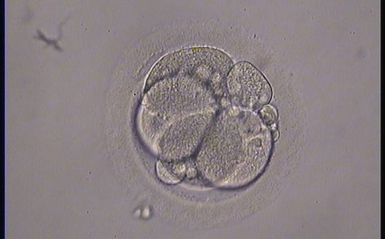 <p><strong>Figure 230</strong></p><p>A 4-cell embryo with 15–20% fragmentation, one of which is a large fragment and the others small and scattered. The blastomeres are evenly sized with no visible nuclei. It was generated by ICSI and cryopreserved.</p>