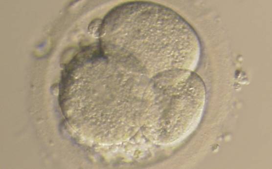 <p><strong>Figure 231</strong></p><p>A 4-cell embryo with 15–20% scattered fragmentation, unevenly sized blastomeres and no visible nuclei. It was generated by IVF and cryopreserved.</p>
