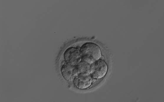 <p><strong>Figure 232</strong></p><p>An 8-cell embryo with around 15–20% scattered fragmentation, evenly sized blastomeres and visible nuclei in some blastomeres. It was generated by IVF but was not transferred.</p>