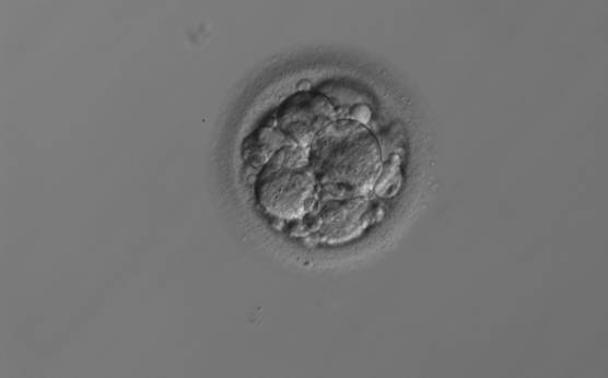 <p><strong>Figure 234</strong></p><p>An 8-cell embryo with 25% scattered fragmentation and evenly sized blastomeres. It was generated by ICSI and transferred but failed to implant.</p>