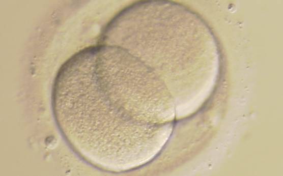 <p><strong>Figure 243</strong></p>

<p>A 2-cell embryo with evenly sized blastomeres and no fragmentation on Day 2. The blastomeres are stage-specific cell size. The embryo was transferred but did not result in a pregnancy.</p>