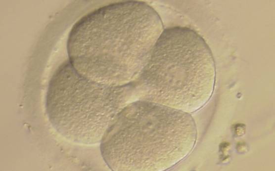 <p><strong>Figure 244</strong></p><p>A 4-cell embryo with evenly sized blastomeres and no fragmentation on Day 2. The blastomeres are stage-specific cell size. Notice the clover shape arrangement of the blastomeres. It was transferred and implanted.</p>