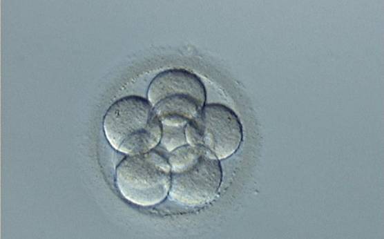 <p><strong>Figure 245</strong></p><p>An 8-cell embryo with evenly sized blastomeres and no fragmentation on Day 3. The blastomeres are stage-specific cell size. It was transferred and resulted in a pregnancy.</p>
