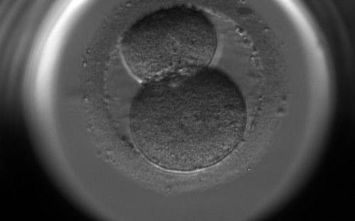 <p><strong>Figure 246</strong></p><p>A 2-cell embryo with unevenly sized blastomeres on Day 2. The blastomeres are not stage-specific cell size.</p>