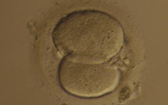 <p><strong>Figure 247</strong></p><p>A 2-cell embryo with unevenly sized blastomeres and up to 10% fragmentation on Day 2. The blastomeres are not stage-specific cell size.</p>