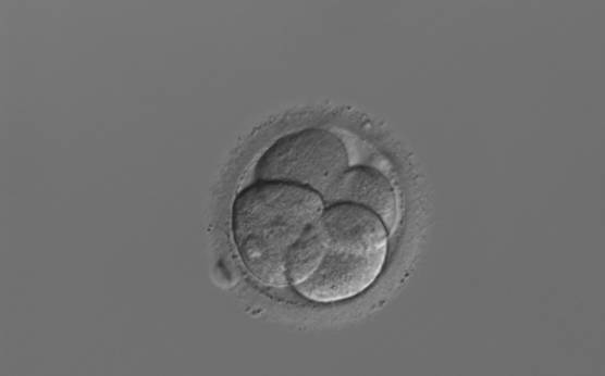 <p><strong>Figure 248</strong></p><p>A 4-cell embryo with unevenly sized blastomeres on Day 2, with the cell to the right being 25% smaller than the cell to the left. The blastomeres are therefore not stage-specific cell size. The embryo was transferred and implanted.</p>
