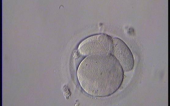 <p><strong>Figure 249</strong></p><p>A 4-cell embryo with unevenly sized blastomeres on Day 2. One blastomere is indistinct in this view. The blastomeres are not stage-specific cell size.</p>