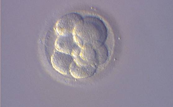 <p><strong>Figure 252</strong></p><p>An 8-cell embryo with unevenly sized blastomeres. The blastomeres are not stage-specific cell size. The embryo was transferred but did not result in a pregnancy.</p>