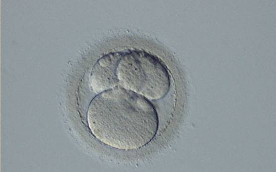 <p><strong>Figure 253</strong></p><p>A 3-cell embryo with one large and two small blastomeres on Day 2. The blastomeres are stage-specific cell size. The embryo was transferred but failed to implant.</p>