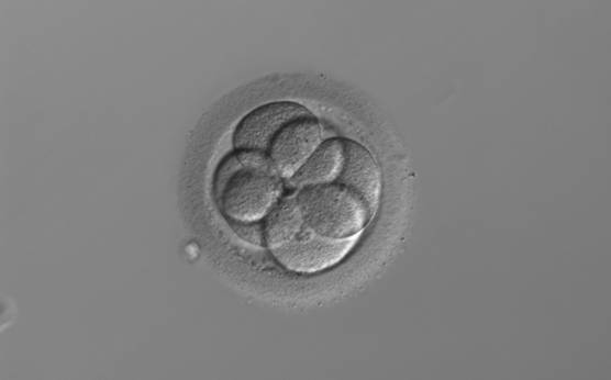 <p><strong>Figure 255</strong></p><p>A 6-cell embryo with two large and four small blastomeres. The blastomeres are stage-specific cell size.</p>