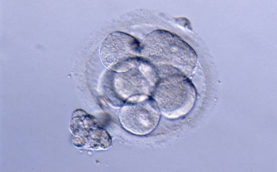 <p><strong>Figure 256</strong></p><p>A 7-cell embryo with one large and six small blastomeres. The blastomeres are stage-specific cell size.</p>